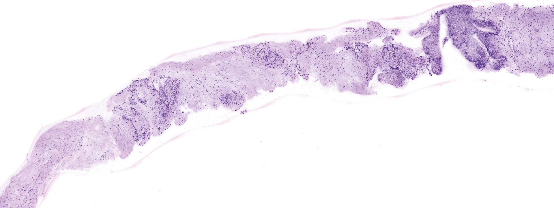 VivaScope 2500 confocal image example 3