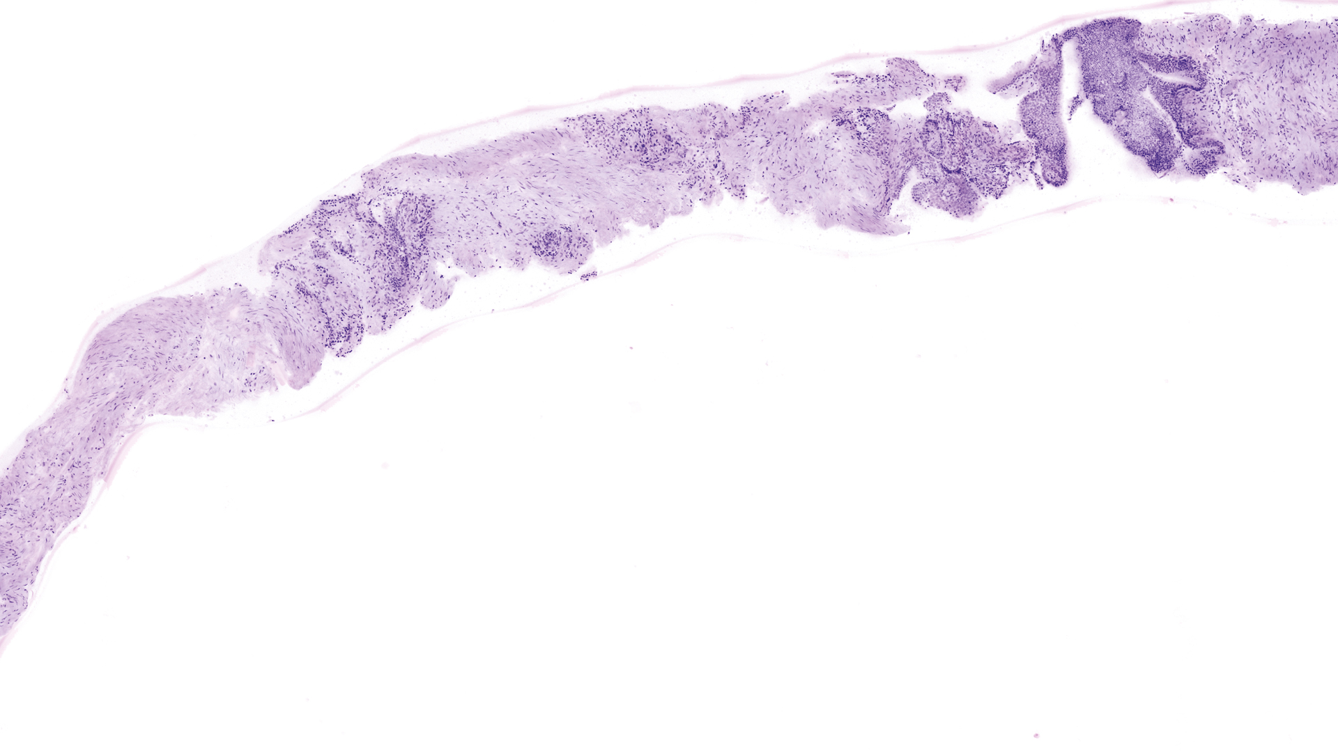 VivaScope 2500 confocal image example 3