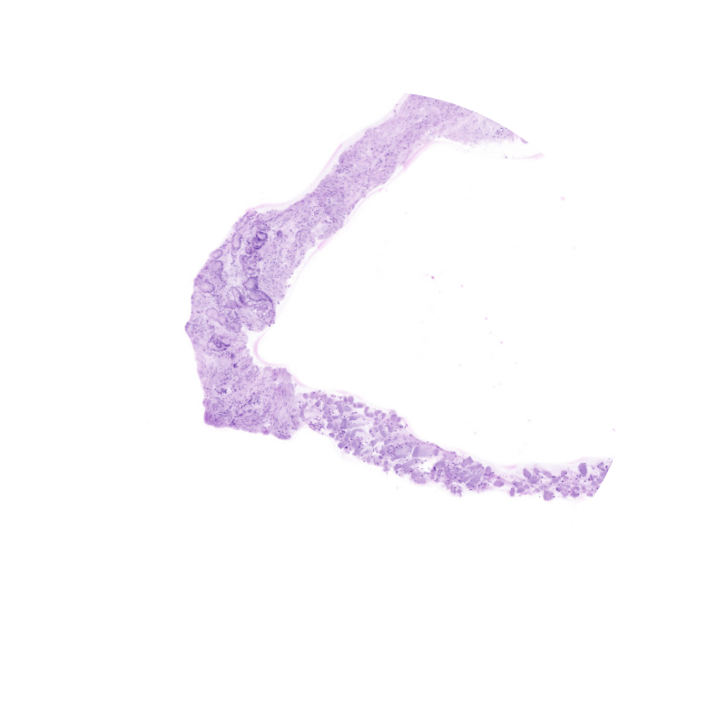 Application 3 digital pathology (FNA / FNB)