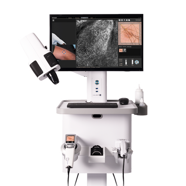 The VivaScope 1500/300 Combo System, confocal laser scan microscope